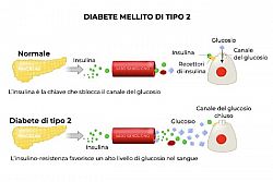 Nuove frontiere terapeutiche per il diabete di tipo 2